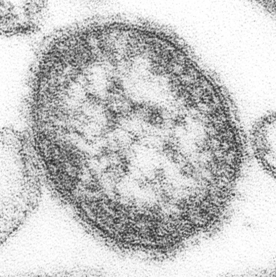 The measles virus used to infect almost everyone, until the vaccine was developed in 1963.
